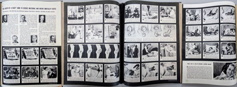 “The Birth of a Baby.” LIFE, April 11, 1938. New-York Historical Society.